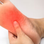 علت داغ شدن کف پا در شب‌